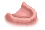 ATMtreatment1
